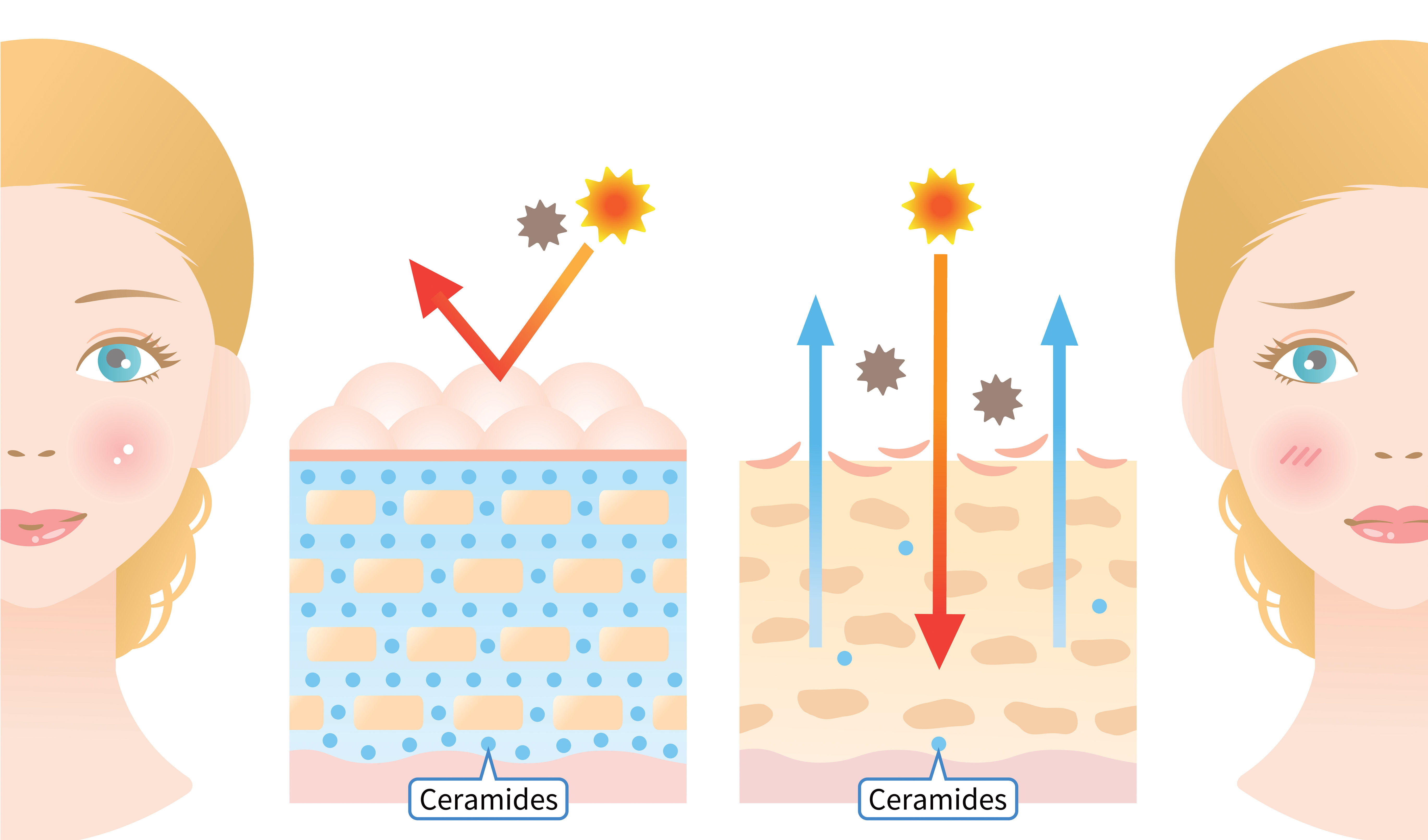 Ceramide là một loại axit béo chiếm đến 50% lượng axit béo có trong Lipid gian bào - 1 trong 3 thành phần cấu tạo nên hàng rào bảo vệ da
