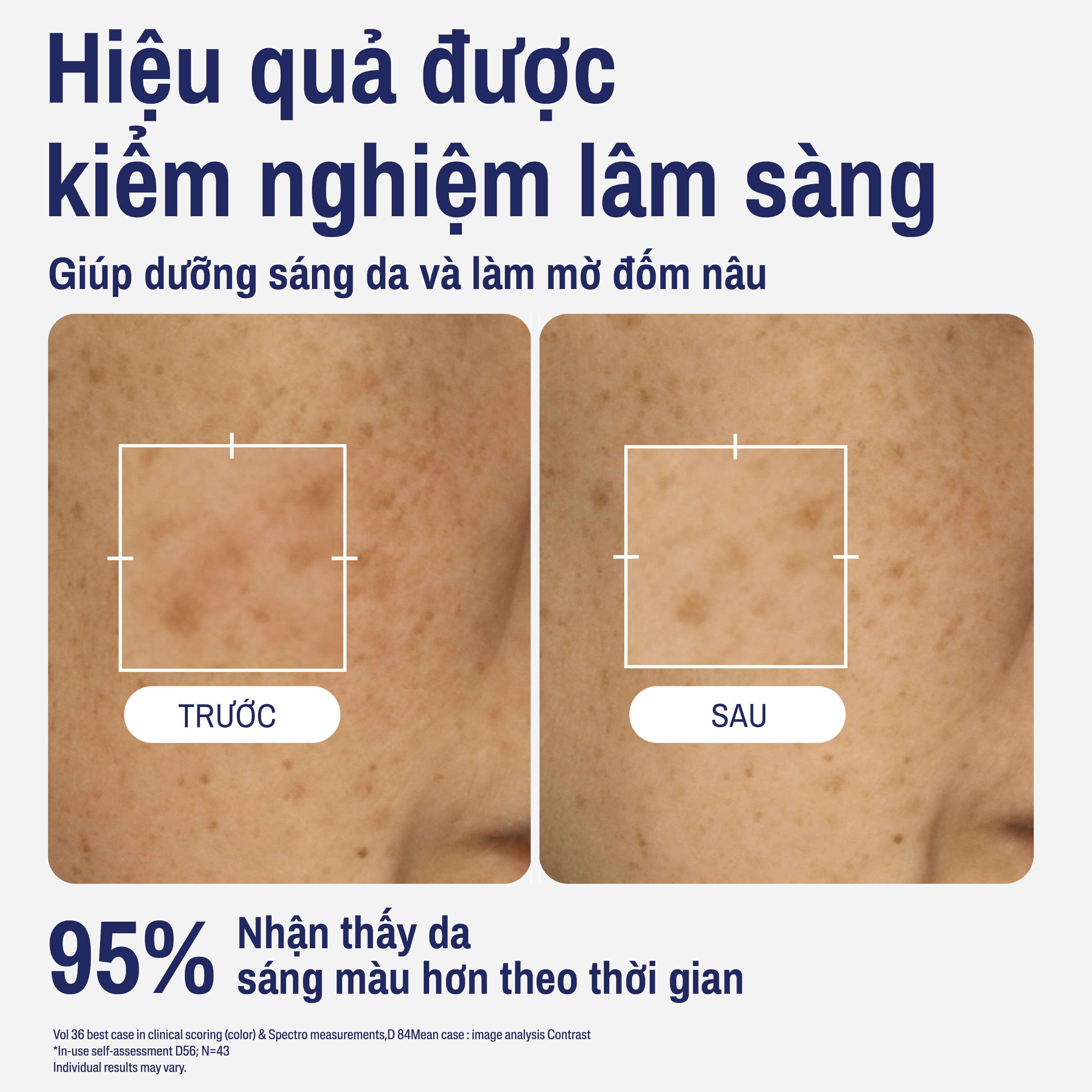 Tinh chất dưỡng da trắng s&aacute;ng Cetaphil Bright Healthy Radiance Perfecting Serum 7