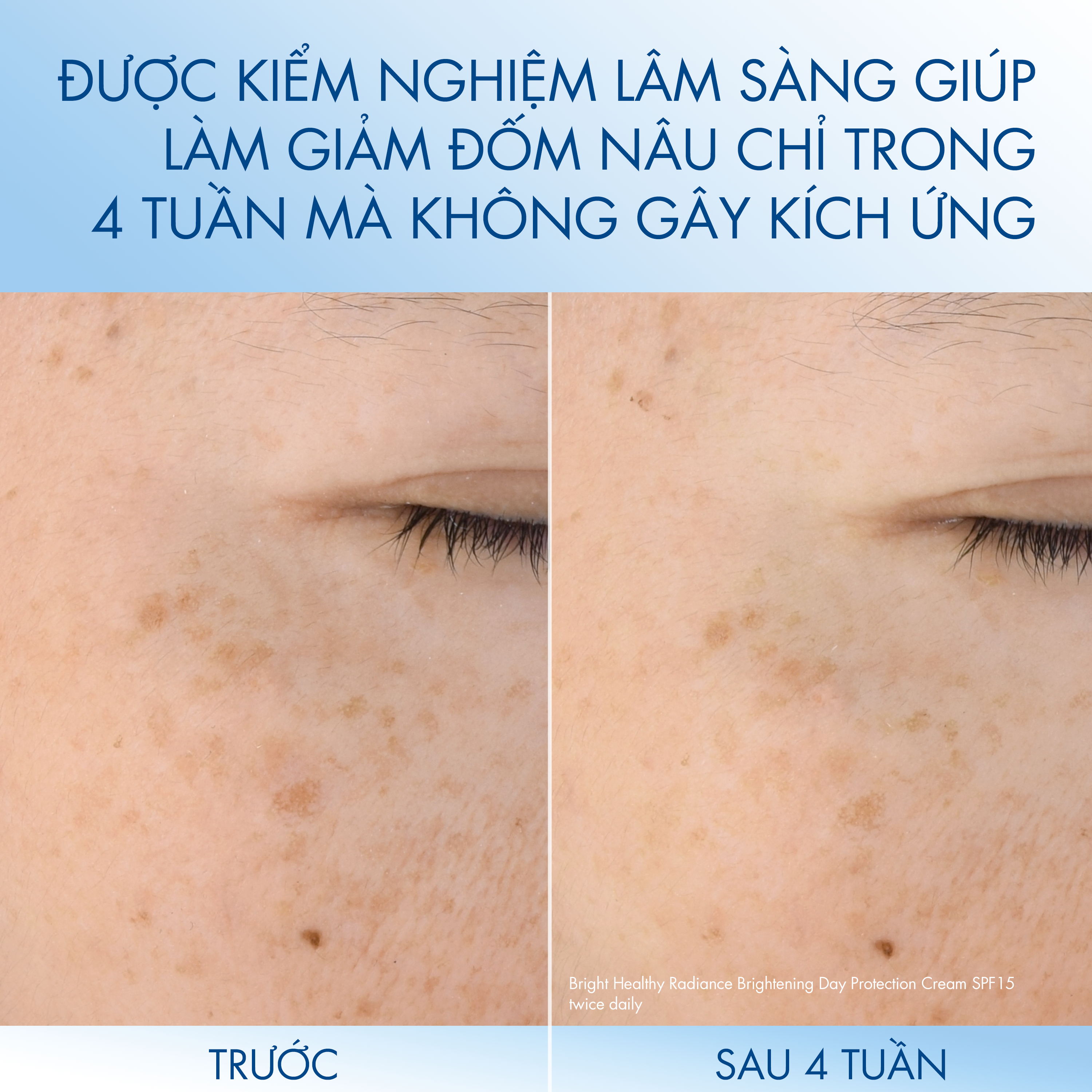 Kem dưỡng ẩm s&aacute;ng da ban đ&ecirc;m Cetaphil Bright Healthy Radiance Brightening Night Comfort Cream